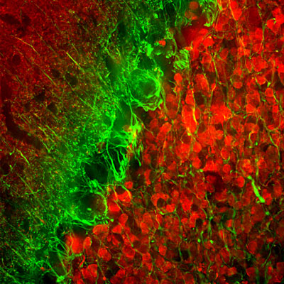 Immunofluorescence of a section of rat cerebellum selectively labeling the axons of granule cells with alpha-internexin (cat. 100-AIN, 1:5000, green) and colabeled with anti-calretinin (red).