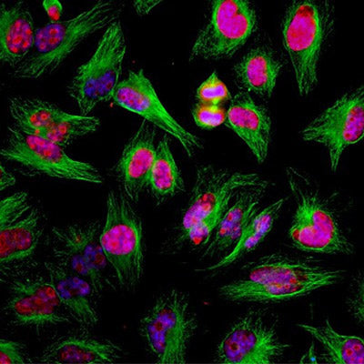 Immunostaining of HeLa cells showing specific labeling of Ki-67 (cat. 1007-Ki67, 1:2000, red) present in cytoplasmic microtubules. Additional immunostaining done with β-tubulin in green and nuclear staining with DAPI (blue). During cell cycle Ki-67 protein is predominantly expressed in the nucleoli of cells during mitosis and interphase, and is not present during quiescence.