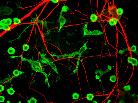 Immunofluorescence of cultured neurons and glia cells showing specific labeling of neuronal processes with Anti-alpha-internexin (cat. 101-AIN, 1:500, red), and specific labeling of microglia with anti-coronin 1a (green).