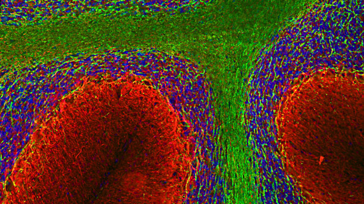 Immunofluorescence of a section of rat cerebellum showing labeling of axons of granule cell and dendrites of Purkinje with alpha-internexin (cat. 101-AIN, 1:5000, red), labeling of the myelin sheaths around the axons with MBP (cat. 1120-MBP, 1:5000, green), and additional nuclear staining with DAPI (blue).