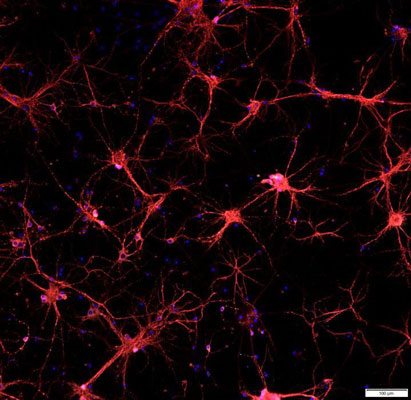 Immunofluorescent image of primary mouse neurons specifically labelling MAP2 (cat. 1099-MAP2, 1:1000, red). The blue nuclear stain is Hoechst. The image was kindly provided by Noah Johnson, University of Colorado, Anschutz Medical Campus.