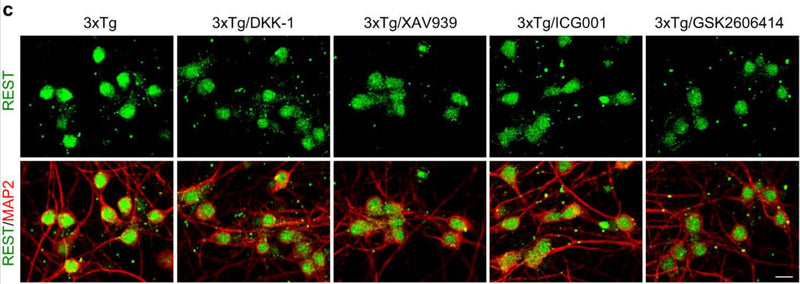 Immunolabeling of REST (green) and neuron marker MAP2 (cat. 1099-MAP2; red) in 3xTg primary cortical neurons (PCNs) shows nuclear REST in neurons treated with vehicle and decreased nuclear REST in 3xTg neurons after a 24-h treatment with the Wnt/β-catenin inhibitors Dickkopf 1 (DKK1), XAV939 and ICG001, or the PERK inhibitor GSK2606414. Image from publication CC-BY-4.0. PMID: 37919281
