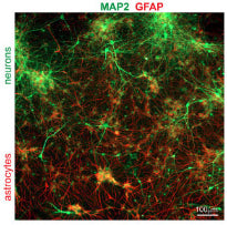 Costaining of the primary brain cells isolated from 18-day embryonic rats (E18). Neurons stained with α-MAP2 (green). Copurified astrocytes stained with α-GFAP (red). Image from publication CC-BY-4.0. PMID: 35652638