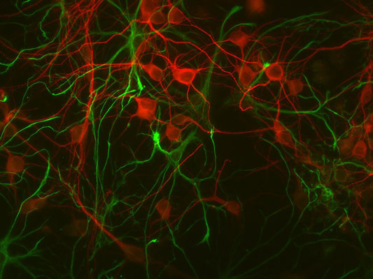 Immunolabeling of mouse cortical cultures labeled with Anti-GFAP (cat. 620-GFAP, 1:1000, green) and anti-MAP2 (1100-MAP2, 1:1000, red).