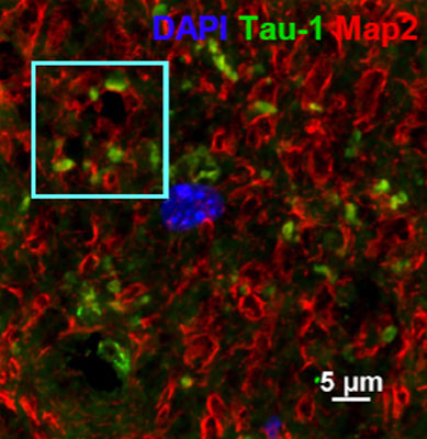 Immunostaining of rat hippocampus showing specific immunolabeling of MAP2 (cat. 1100-MAP2, red, 1:1000), Tau-1 (green), and nuclear DNA labeled with DAPI (blue). Photo courtesy of the Miriam Zamorano, University of Texas Health Science Center at Houston.