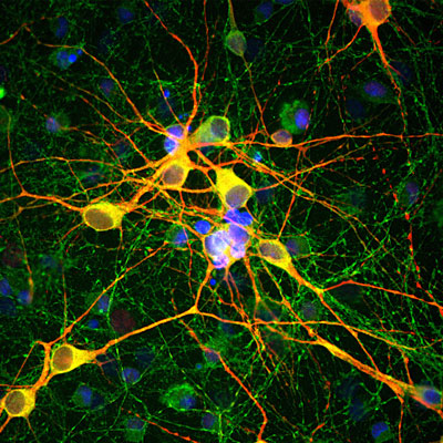 Immunofluorescence of cortical neuron-glial cell culture from E20 rat labeled with Anti- MAP2(cat. 1100-MAP2, red, 1:10,000), and Anti-Tau (green). The blue is DAPI staining of nuclear DNA. The anti-MAP2 antibody stains dendrites and perikarya of neurons, while the anti-TAU antibody labels neuronal perikarya, dendrites and also axonal process. As a result perikarya and dendrites appears orange-yellow, since they contain both MAP2 and tau, while axons are green.