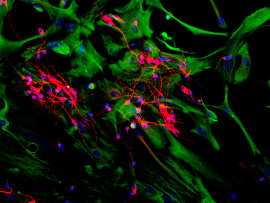 Immunostaining of mixed neuron and glial cultures showing specific cytoplasmic labeling of dendrites and perikarya of neuronal cells with anti-microtubule associated protein 2C/D (cat. 1101-MAP2C, red, 1:2500) and specific fibroblast, astrocyte labeling with anti-vimentin (cat. 2105-VIM, green, 1:500). The blue stain is DAPI to identify nuclei.