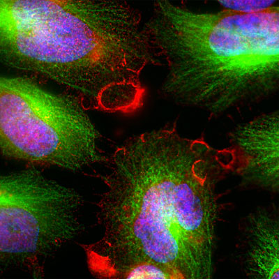 Immunolabeling of HeLa cells showing specific labeling of the MARCKs protein (anti-MARCKS antibody, cat. 1107-MARCKS, red, 1:5000) and β-tubulin protein (green). Anti-MARCKS binds MARCKs protein expressed in the plasma membrane and cytoplasm. The blue is Hoechst staining the nuclear DNA. 