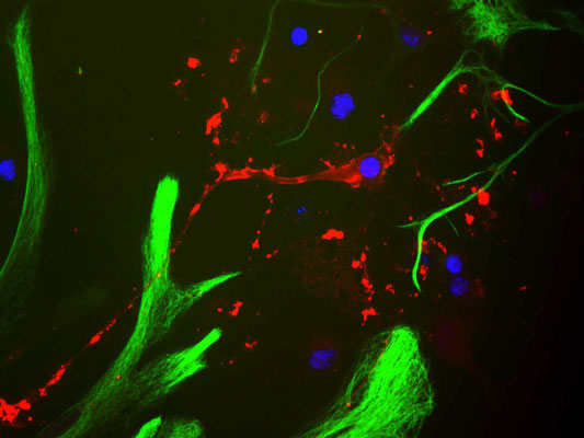 Immunostaining of cultured neonatal rat neurons and glia stained with anti-myelin basic protein antibody (cat. 1120-MBP, red, 1:500). The blue stain is to identify nuclear DNA. Note the antibody stains the myelin basic protein located in oligodendrocyte and myelin sheathes around axons in the cells.