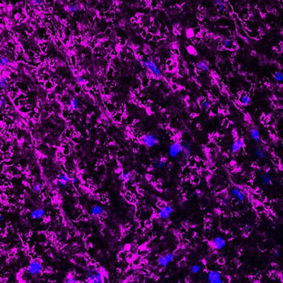 Immunofluorescence of a perpendicular section from mouse spinal cord gray matter (upper left corner) and white matter (lower right corner) labeling myelin basic protein (cat. :1120-MBP, magenta, 1:500) from oligodendrocytes and myelin sheaths. The blue is DAPI counterstaining nuclear DNA. Image kindly provided by Dr. Rodolfo Gatto and Dr. Gerardo Morfini, Department of Anatomy and Cell biology, University of Illinois at Chicago.