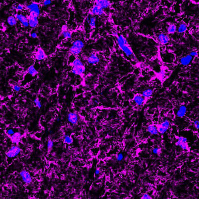 Immunofluorescence of a cross-section from mouse corpus callosum labeling myelin basic protein (cat. : 1120-MBP, magenta, 1:500) in oligodendrocytes and myelin sheaths. The blue is DAPI counterstaining nuclear DNA. Image kindly provided by Dr. Rodolfo Gatto and Dr. Gerardo Morfini, Department of Anatomy and Cell biology, University of Illinois at Chicago.
