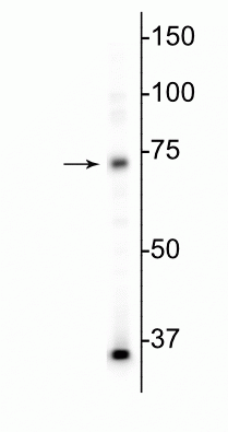 Western blot of mouse whole brain lysate showing specific immunolabeling of the MeCP2 protein at ~75 kDa.