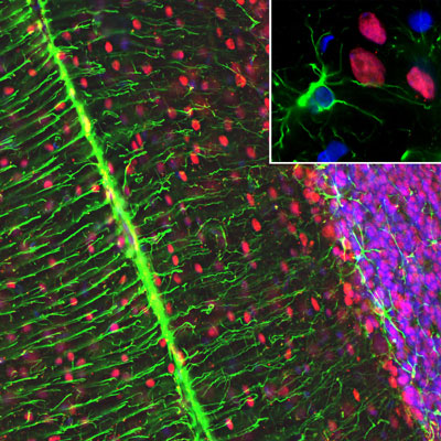 Immunofluorescence of a section of rat cerebellum showing specific labeling of MeCP2 (cat. 1205-MeCP2, 1:1000, red) in nuclei of neurons and specific labeling of GFAP (cat. 621-GFAP, 1:5000, green) in the network of astroglial cells and projections of Bergmann glia, and Hoechst staining of nuclear DNA.