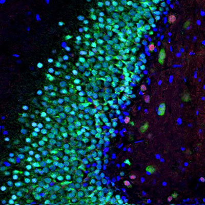 Immunostaining of a section of rat hippocampus showing specific nuclear immunolabeling of MeCP2 (cat. 1205-MECP2, red, 1:1000) and FOX3 (green). The blue is DAPI staining of nuclear DNA.
