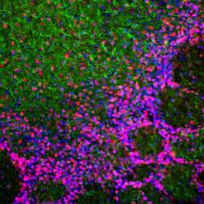 Immunostaining of a section of rat olfactory bulb showing specific labeling of MeCP2 in neuronal nuclei (Cat. No. 1207-MECP2, red, 1:2000) and alpha synuclein (green). The blue is DAPI staining of nuclear DNA.