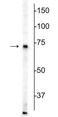 Western blot of mouse whole brain lysate showing specific immunolabeling of the MeCP2 protein at ~75 kDa.