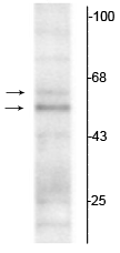 Western blot of rat hippocampal lysate showing specific immunolabeling of the ~50 kDa TR-α1 and the ~58 kDa TR-α2 protein. 