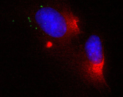 Immunofluorescence staining of human blood-brain barrier endothelial cells, HMEC 3, showing specific labeling of actin (cat. 125-ACT, red, 1:200) The cell nuclei are stained in blue with DAPI. Photo credit of Yancy Ferrer-Acosta/Henrique Martins, Universidad Central Del Caribe, PR.