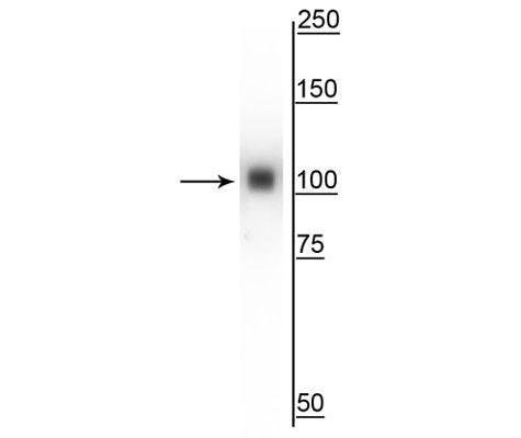 Western blot of mouse whole brain lysate showing specific immunolabeling of the ~105 kDa α-actinin 4 protein.