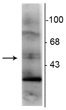 Western blot of rat hippocampal lysate showing specific immunolabeling of the ~48 kDa RXR-γ isotype. 