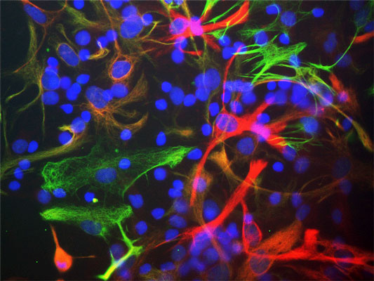 Immunostaining of cultured neonatal rat neurons and glia stained with anti-nestin antibody (cat. 1435-NES, red, 1:500) and anti-vimentin antibody (cat. 2105-VIM, green, 1:500). The blue is Hoechst staining for nuclear DNA. Astrocytes and neuronal stem cells stain strongly and specifically in a clearly filamentous fashion with the anti-Nestin antibody. The presence of Nestin indicates that the cells are developing astrocytes, neuroblasts or undifferentiated neural stem cells.