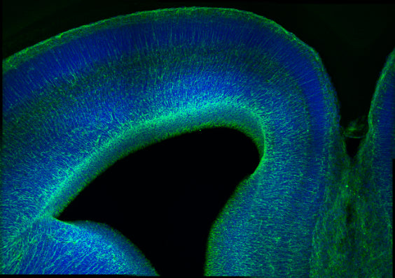 Immunolabeling of the coronal section of an embryonic day 15.5 mouse cortex showing specific labeling of Nestin (cat. 1435-NES, 1:500; green). Nuclei stained with DAPI (blue). Image kindly provided by Alyssa Treptow, University of California, Riverside.