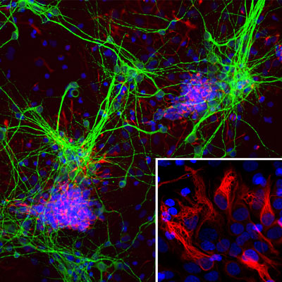 Immunostaining of cultured E20 rat cortical neurons and glia stained with anti-nestin antibody (cat. 1435-NES, red, 1:500) and anti-MAP2 antibody (cat. 1100-MAP2, green, 1:500). The blue is Hoechst staining for nuclear DNA. The nestin antibody labels developing astrocytes and neuronal stem cells in a clearly filamentous fashion, while the MAP2 antibody stains dendrites and perikarya of mature neurons.