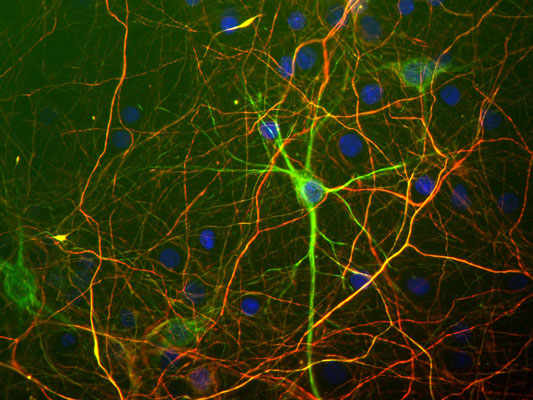 Immunostaining of mixed cultured rat neurons and glia stained with anti-NFH antibody (cat. 1451-NFH, red, 1:25,000) and anti-NFL antibody (cat. 1452-NFL, green, 1:100).