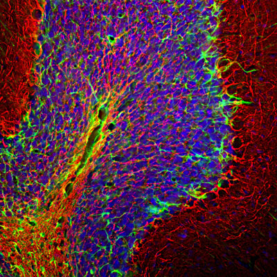 Immunofluorescence of a section of rat cerebellum showing specific labeling of Neurofilament H (cat. 1451-NFH, 1:25,000, red) in nuclei of neurons and specific labeling of GFAP (cat. 620-GFAP, 1:5000, green) in astrocytes and other glial cells, and DAPI staining of nuclear DNA. 