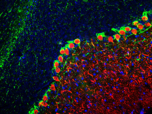 Immunofluorescence of a section of rat cerebellum showing specific labeling of the axons with anti-neurofilament H antibody (cat. 1451-NFH, green, 1:25,000). The section is colabeled with anti-calbindin (cat. 302-CALB , red, 1:1000) labeling the dendrites of Purkinje cells. The blue is DAPI staining nuclear DNA.