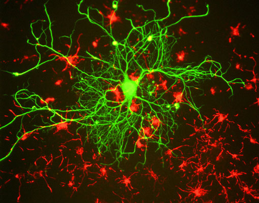 Immunostaining of mixed cultured rat neurons stained with anti-NFL antibody (cat. 1452-NFL, green, 1:100) and anti-alpha internexin.