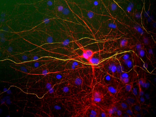 Immunostaining of mixed cultured rat neurons and glia stained with anti-NFL antibody (cat. 1453-NFL, red, 1:5000). The NF-L protein is assembled into neurofilaments which are found throughout the axons, dendrites, and perikarya as shown above.