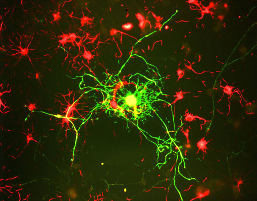 Immunostaining of cultured rat neurons showing labeling of NF-M (cat. 1454-NFM, green, 1:100) in mature neurons.