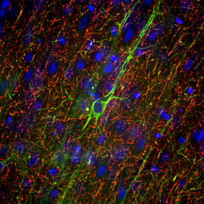 Immunofluorescence of a section of adult rat frontal cortex labeled with anti-Neurofilament-M (cat. 1454-NFM, 1:5000, red) and anti-Neurofilament-H (cat. 1451-NFH, 1:5000, green). The anti-NFM specifically labels neuron cell bodies and dendrites of pyramidal neurons, while the anti-NFH labels the network of neuronal axons only. The blue is Hoechst staining of nuclear DNA.