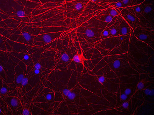 Immunostaining of cultured rat neurons and glia stained with anti-NFM antibody (cat. 1455-NFM, red, 1:1000) and DNA is stained blue.