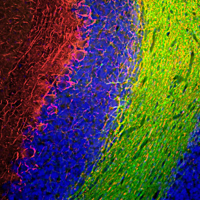 Immunofluorescence of a section of rat cerebellum labeled with anti-Neurofilament-M (cat. 1455-NFM, 1:1000, red) and anti-CNP (green). The anti-NFM labels the network of axons of basket neurons and other neurons. The blue is DAPI staining of nuclear DNA. 