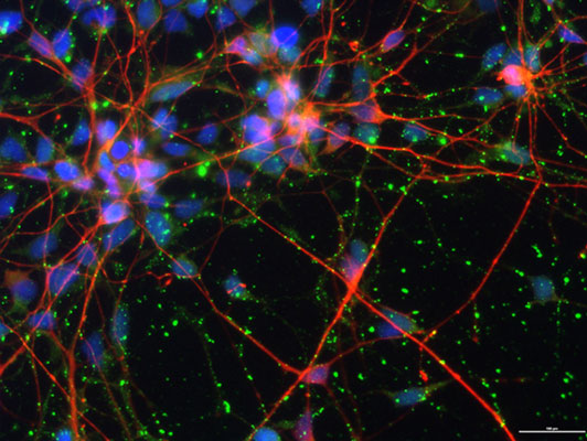 Immunofluorescence of healthy iPSC-derived neurons labeled with Anti-NMDA Receptor, NR2B subunit (cat. 1498-NR2B, green, 1:100) and Anti-TuJ1 (red). The blue is Hoechst staining of nuclear DNA. Image kindly provided by Dr. Allison Ebert, Medical College of Wisconsin.