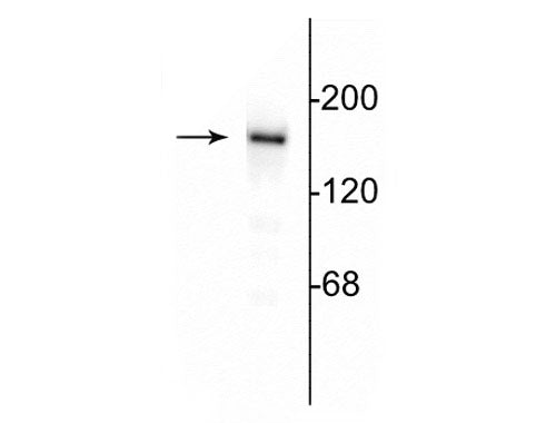 Western blot of 10 ug of rat hippocampal lysate showing specific immunolabeling of the ~180 kDa NR2B subunit of the NMDA receptor.