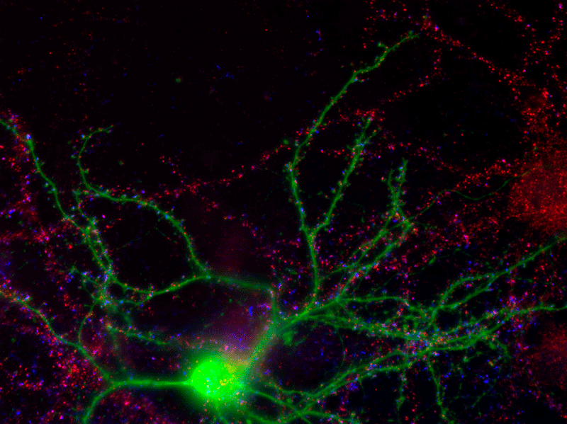 Immunostaining of 21 DIV nucleofected mouse striatal neuron (green) co-cultured with cortical neurons showing nice punctate labeling of the N-terminal NR2A subunit (red, 1:500) in both the medium spiny neurons and the large pyramidal cell in the upper right. Photo courtesy of Dr. A.J. Milnerwood, Dr. Lynn Raymond Lab, University of British Columbia. 