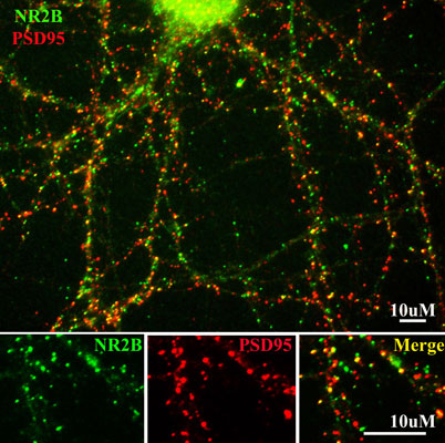 Immunostaining of 14 DIV rat cortical neurons showing NR2B (green, 1:400) and PSD95(red). Photo courtesy of Gang Liu. 