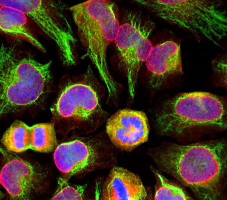 Immunolabeling of HeLa cells stained with anti-nuclear pore complex antibody (cat. 1515-NPC, red, 1:100) and rabbit anti-vimentin antibody (cat. 2105-VIM, green, 1:10,000). The blue is DAPI staining nuclear DNA. The anti-nuclear pore complex antibody reveals strong granular labeling of the nuclei corresponding to the protein. The anti-vimentin antibody specifically labels intermediate filaments.