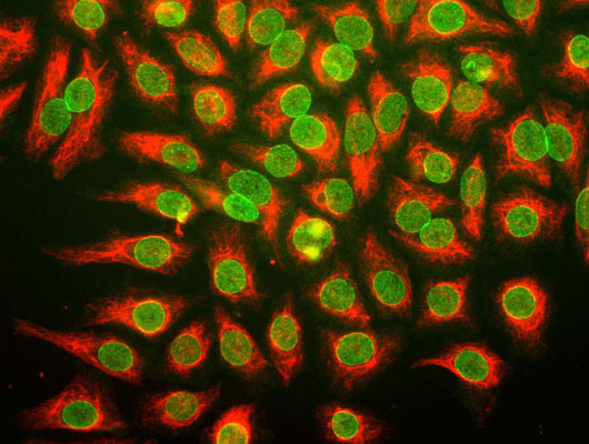 Immunostaining of HeLa cells stained with anti-nuclear pore complex antibody (cat. 1515-NPC, green, 1:100) and rabbit anti-vimentin antibody (cat. 2105-VIM, red, 1:500).