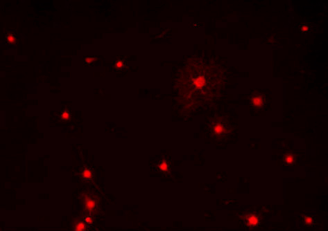 Immunostaining of primary rat oligodendrocytes using anti-Olig1 (cat. 1537-OLIG1, red, 1:100). 