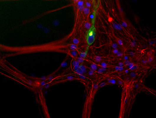 Immunostaining of cultured newborn rat neurons and glia showing peripherin (cat. 1630-PER, green, 1:200) and neurofilament L (red). The nuclear DNA is stained blue.