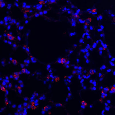 Immunofluorescence of mouse lung showing specific labeling of alveolar type 2 epithelial cells using anti-Prosurfactant Protein C antibody in red. Nuclei are stained blue.