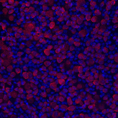 Immunostaining of mouse retinal ganglion cells showing specific immunolabeling of RBPMS (1:1000) in red. Photo courtesy of Allen Rodriguez, University of California, Los Angeles.