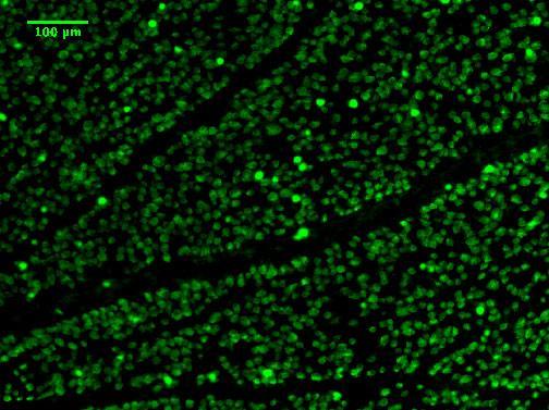 Immunostaining of mouse flat mounted retina showing specific immunolabeling of Anti-RBPMS (cat. 1832-RBPMS, 1:250). Photo courtesy of the Feldhem Lab at University of California, Santa Cruz.