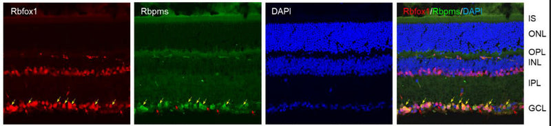 Immunostaining of Rbfox1 (red) , RBPMS (green), and DAPI (blue) in 22-month-old mouse retinas. Image from publication CC-BY-4.0. PMID: 36359797
