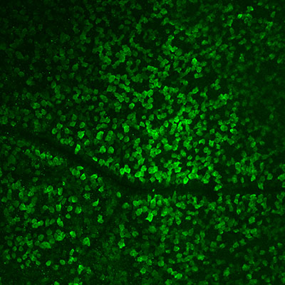 Immunostaining of mouse retinal ganglion cells (whole mount) labeling RBPMS (Cat no. 1832-RBPMS, 1:500, green). Image kindly provided by Sui Wang, Stanford University.