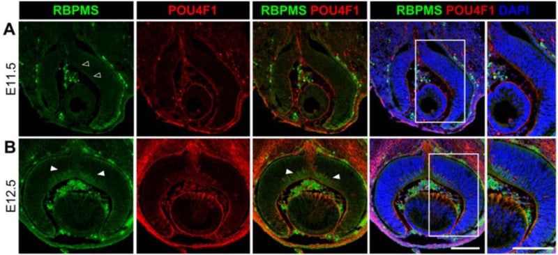 Cryosections of wild type developing retinas at (A) E11.5 and (B) E12.5 were immunolabeled with anti-RBPMS (cat. 1832-RBPMS, 1:500; green) and anti-POU4F1 (red) and nuclear counterstained with DAPI (blue). Arrowheads indicate RBPMS expression and RBPMS-POU4F1 co-expression in the central retina ((B), left and central panels, respectively). Far right panels show the enlarged views of the boxed regions. Image from publication CC-BY-4.0. PMID: 37566030